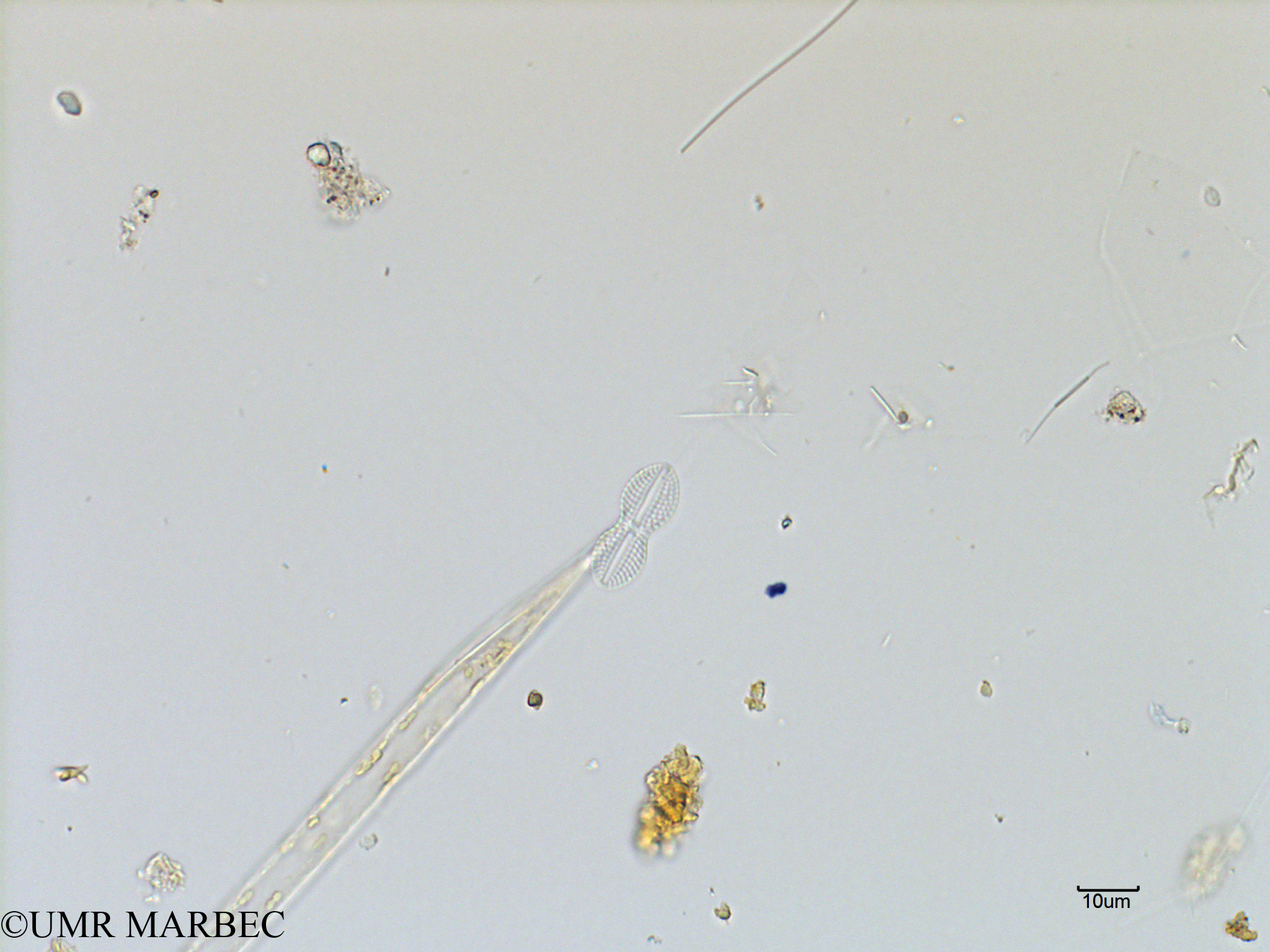 phyto/Scattered_Islands/mayotte_lagoon/SIREME May 2016/Diploneis spp (MAY3_diploneis).tif(copy).jpg